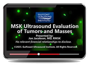 MSK Ultrasound Evaluation of Tumors and Masses - Online Video
