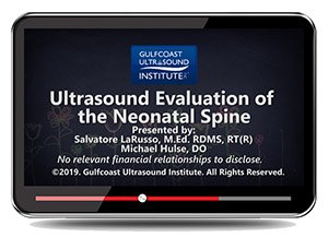  Ultrasound Evaluation of the Neonatal Spine - Online Video