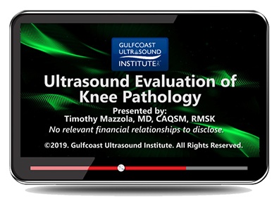 Ultrasound Evaluation of Knee Pathology - Online Video