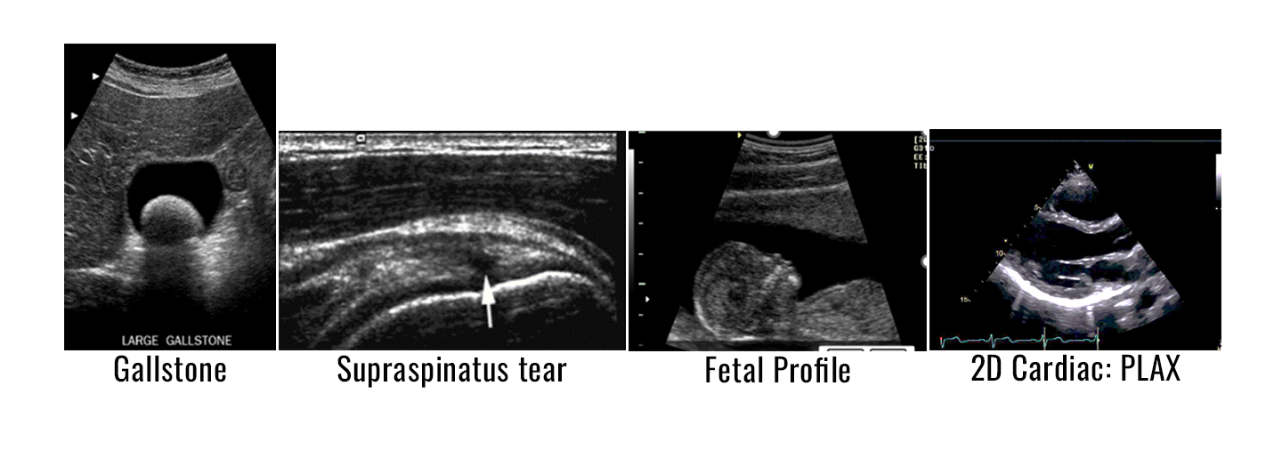 POCUS for Family and Internal Medicine