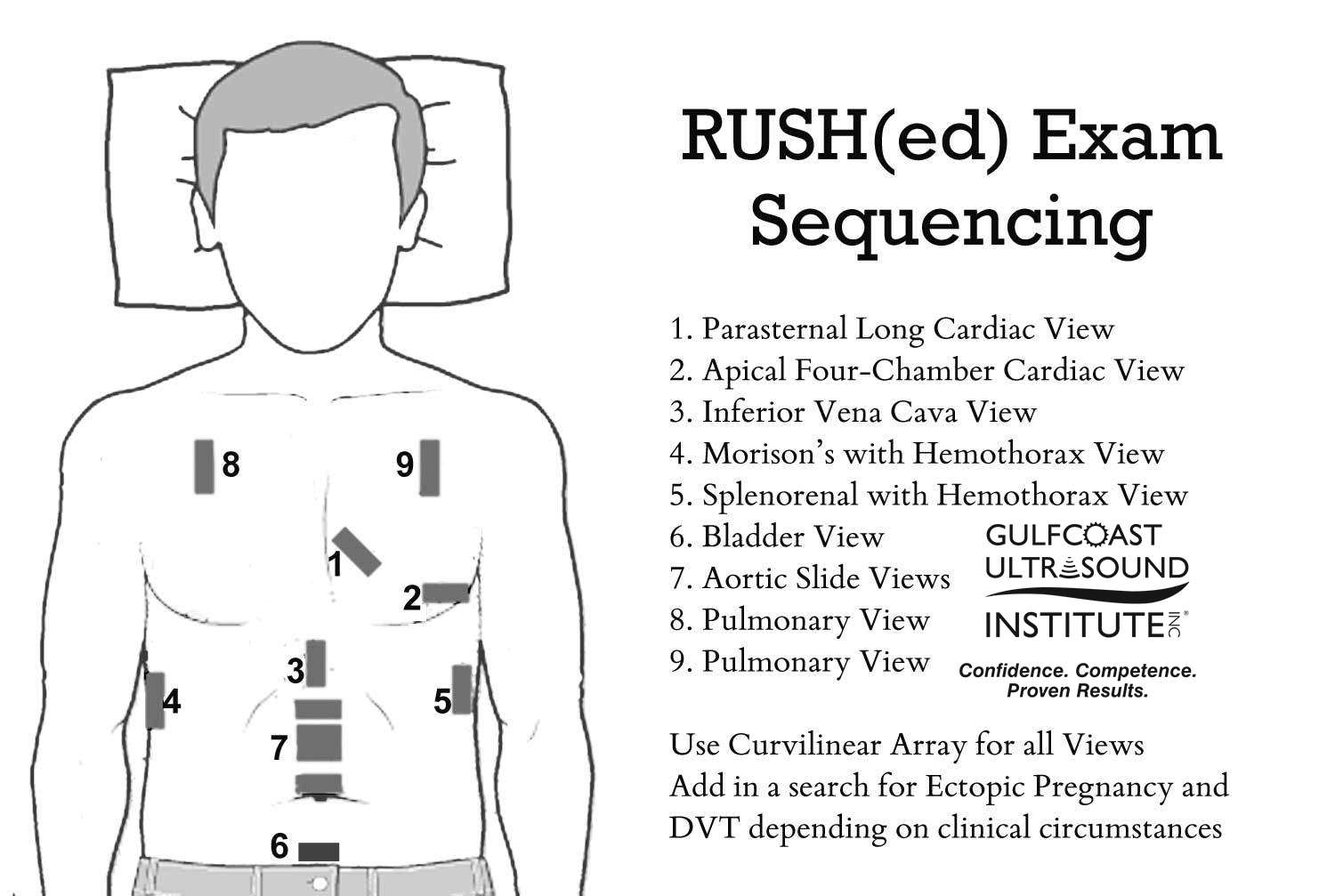 Rapid Ultrasound for Shock & Hypotension (RUSH): A systematic approach to evaluating patients presenting to the ED with undifferentiated hypotension