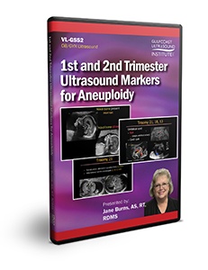 1st and 2nd Trimester Ultrasound Markers for Aneuploidy - DVD