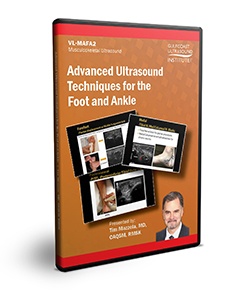 Advanced Ultrasound Techniques for the Foot and Ankle - DVD