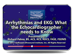 Arrhythmias and EKG: What the Echocardiographer Needs to Know
