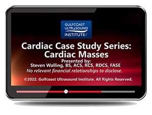 Cardiac Case Study Series: Cardiac Masses
