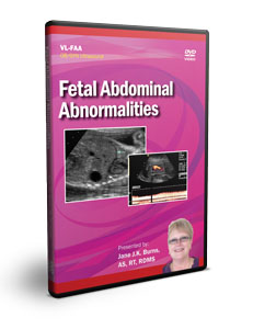Fetal Abdominal Abnormalities - DVD