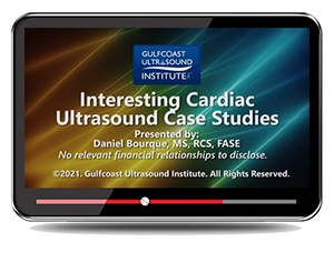 Interesting Cardiac Ultrasound Case Studies