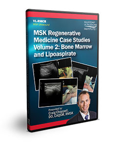 MSK Regenerative Medicine Case Studies Volume 2: Bone Marrow and Lipoaspirate - DVD