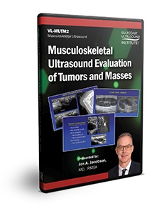 MSK Ultrasound Evaluation of Tumors and Masses - DVD