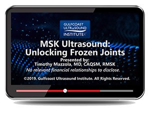 MSK Ultrasound: Unlocking Frozen Joints