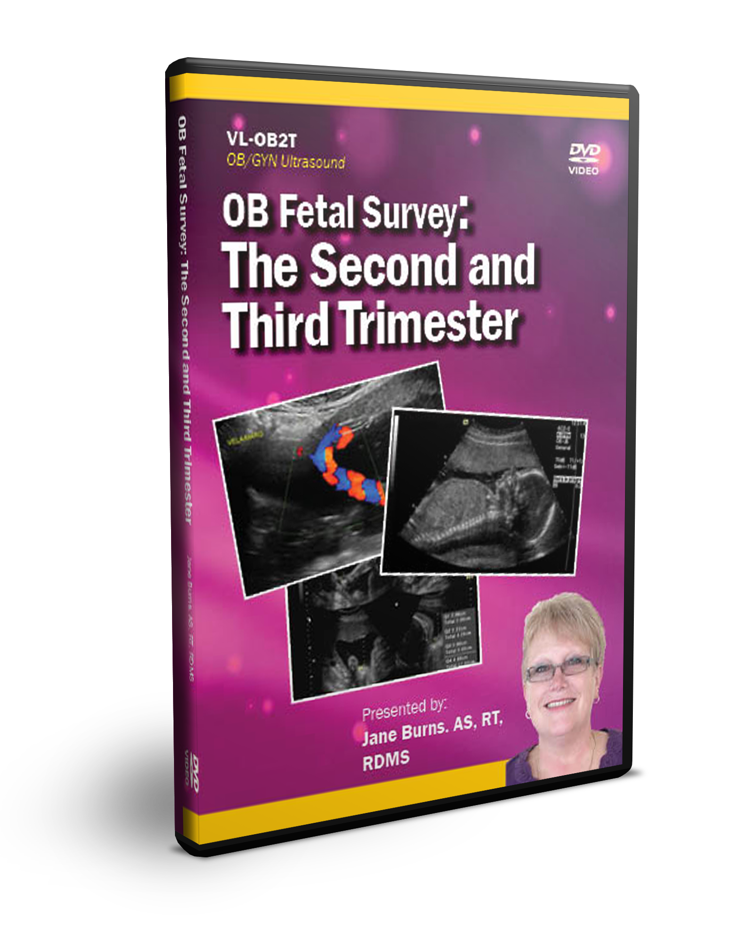 GYN Ultrasound Protocol Manual Including Transabdominal And Endova