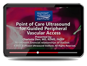 Point of Care Ultrasound for Guided Peripheral Vascular Access