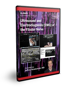 Ultrasound and Electrodiagnosis (EMG) of the Fibular Nerve - DVD