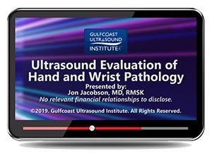 Ultrasound Evaluation of Hand and Wrist Pathology