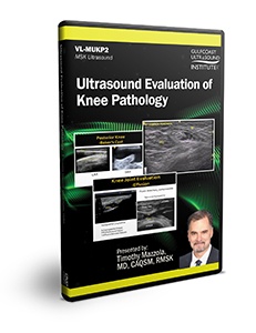 Ultrasound Evaluation of Knee Pathology - DVD