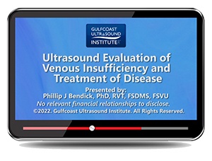 Ultrasound Evaluation of Venous Insufficiency and Treatment of Disease