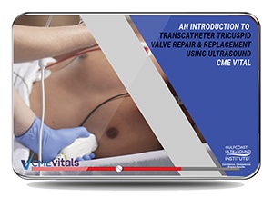 An Introduction to Transcatheter Tricuspid Valve Repair & Replacement Using Ultrasound