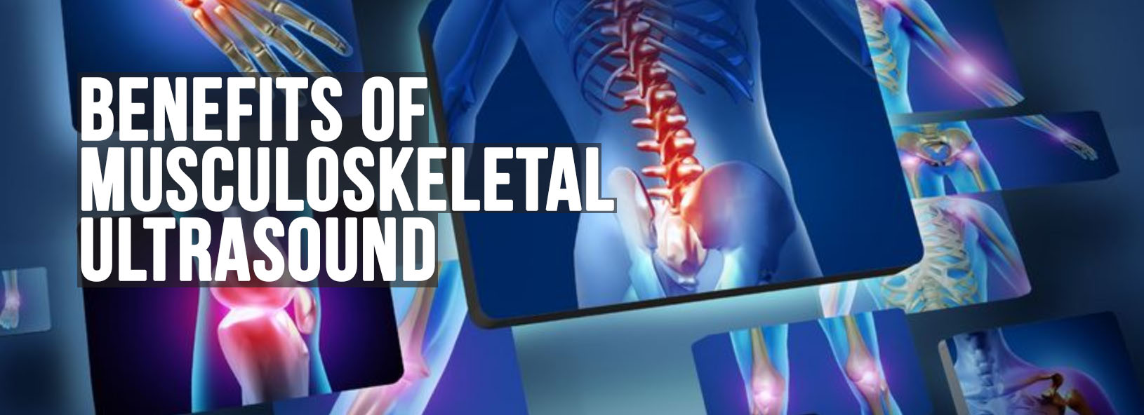 What are the Benefits of Musculoskeletal Ultrasound
