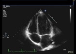 Where is the best live echocardiography hands on course?