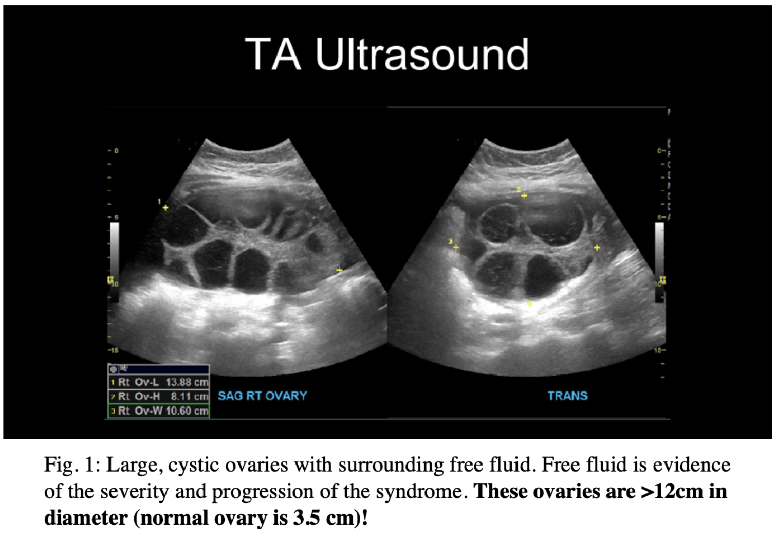 Ultrasound News | Gulfcoast Ultrasound News Blog | Online Ultrasound Course