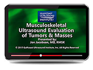 CME - MSK Ultrasound Evaluation of Tumors and Masses
