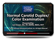 CME - Normal Carotid Duplex/Color Examination